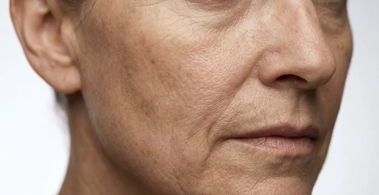 Vue anatomique du visage montrant les zones d'affaissement et les vecteurs de vieillissement